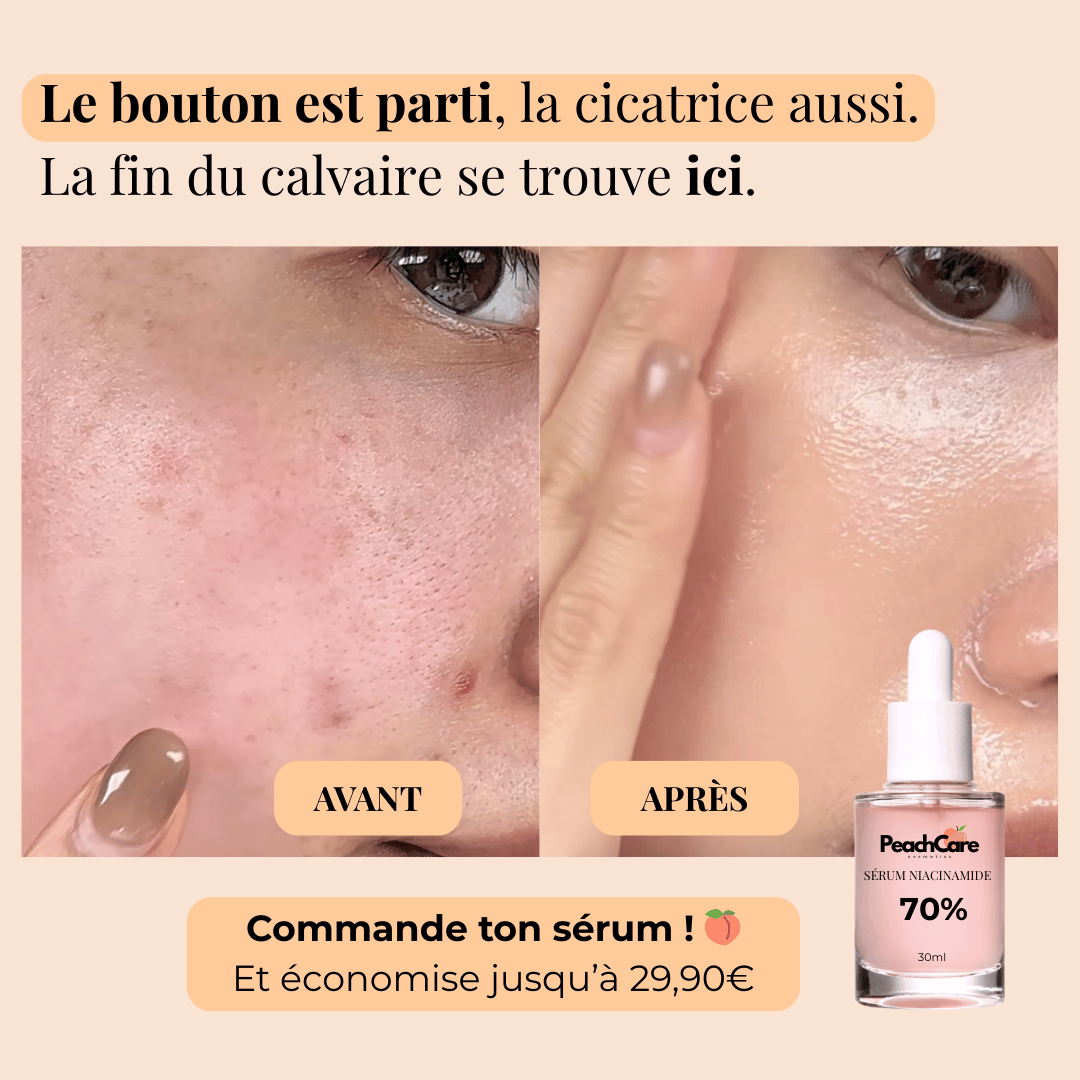 Sérum Niacinamide - Soin des cicatrices post-acné