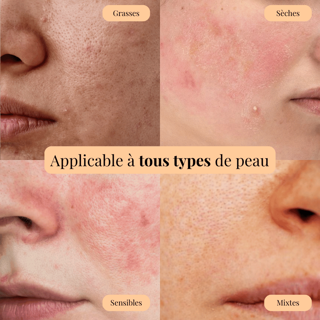 Sérum Niacinamide - Soin des cicatrices post-acné